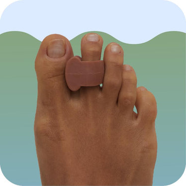 Bunion